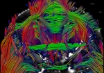 Magnetic resonance imaging (MRI) concept image