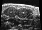 Ultrasound concept image