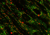 Correlative Light and Electron Microscopy (CLEM) image