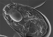 Cryo-EM and Single Particle cryo-EM image
