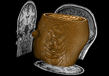 Human MRI image