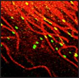 CCL2 vesicles are mobilized on microtubules and docked on actin fibers in inflamed endothelial cells