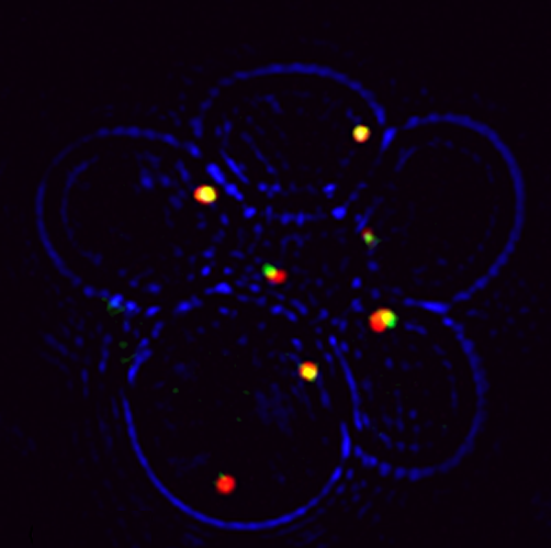 MS2-tagged PEX14 mRNA (green) co-localizes with peroxisomes  (red)