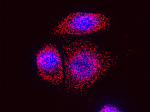 HER2 mRNA (red) visualized by single-molecule FISH in SKBR3 cells