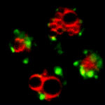 Golgi protein, GFP-Yif1, localizes to late endosomes (green) in cells lacking BTN1; note vacuoles are labeled in red