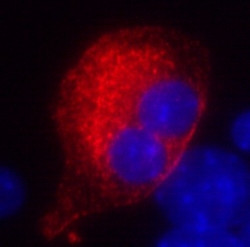 Insulin positive reprogrammed binucleated acinar cell