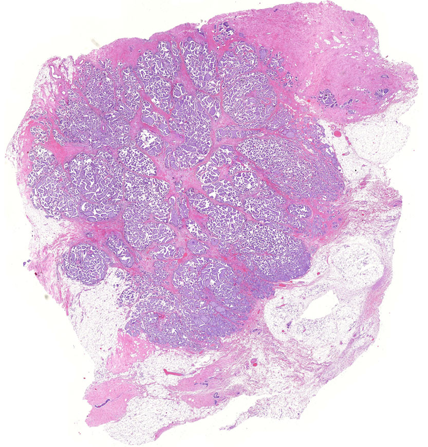  For functional reprogramming in the tumor microenvironment