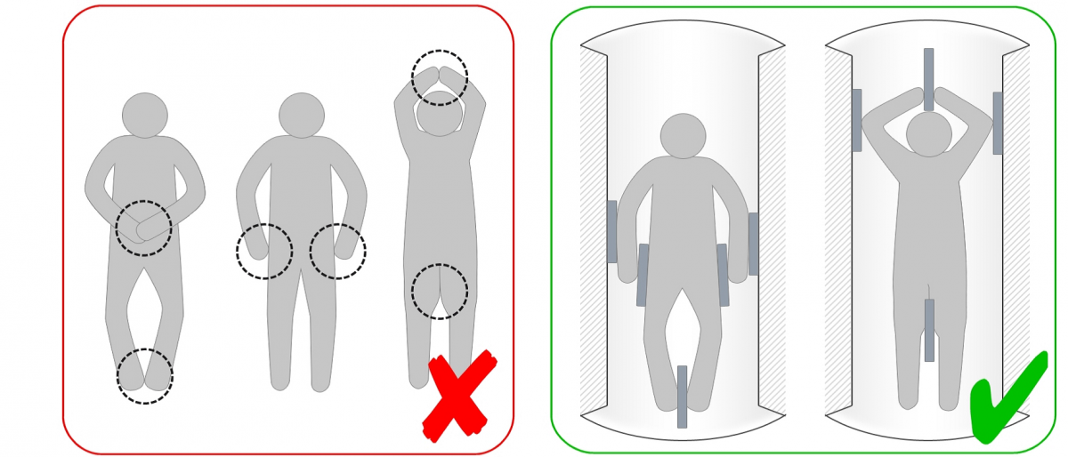 MR Safety: Respiratory Stimulators - Questions and Answers ​in MRI