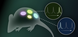 Multiplexed MR Imaging