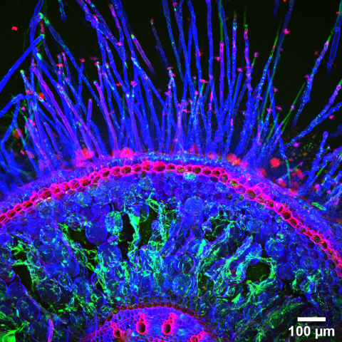 mRNA molecules representing different genes, reflecting different metabolic activities