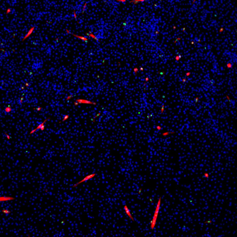 The surprising sight that appeared under the microscope: Muscle stem cells taken from mice before (bottom image) and following a 24-hour exposure (top image) to a molecule blocking the ERK enzyme. The mouse myoblasts had undergone rapid fusion, creating muscle fibers (red) with multiple nuclei (blue).