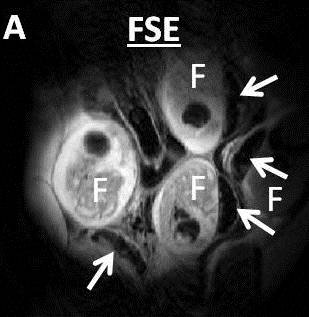 Anatomical image of a pregnant mouse showing multiple fetoplacental units.