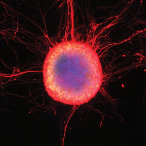 A colony of human embryonic stem cells differentiating into neuronal cells with long extending axons