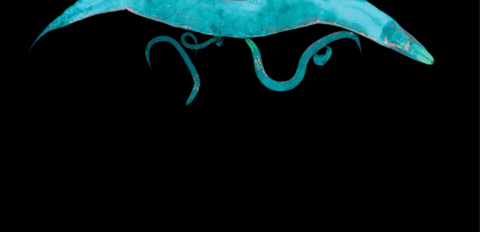 C. elegans, a model organism for research, is about 1mm in length. (Image from the Oren-Suissa lab)