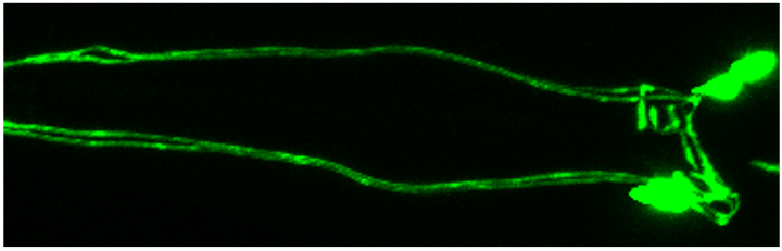 Dopamine neurons