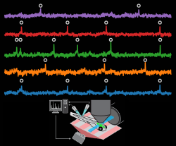Voltage imaging of neural computations