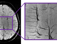 High resolution anatomical imaging picture no. 1