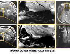 High resolution anatomical imaging picture no. 2