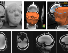 3D printed head-shaped phantom picture no. 1
