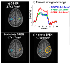 Functional SPEN MRI 