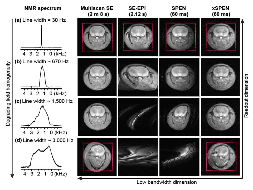 xSPEN imaging