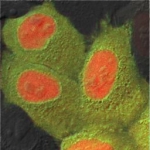 Cell culture showing cytoplasmic green and nuclear red fluorescence.