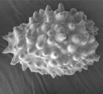SEM image of a Ficus cystolith