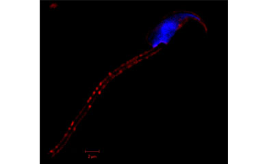 Murine Oviductosome (red)-sperm membrane fusion