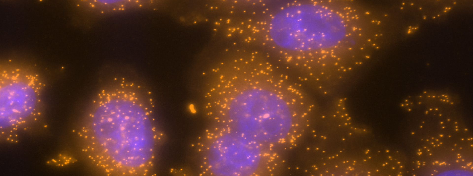 Post-transcriptional fate of long RNA molecules
