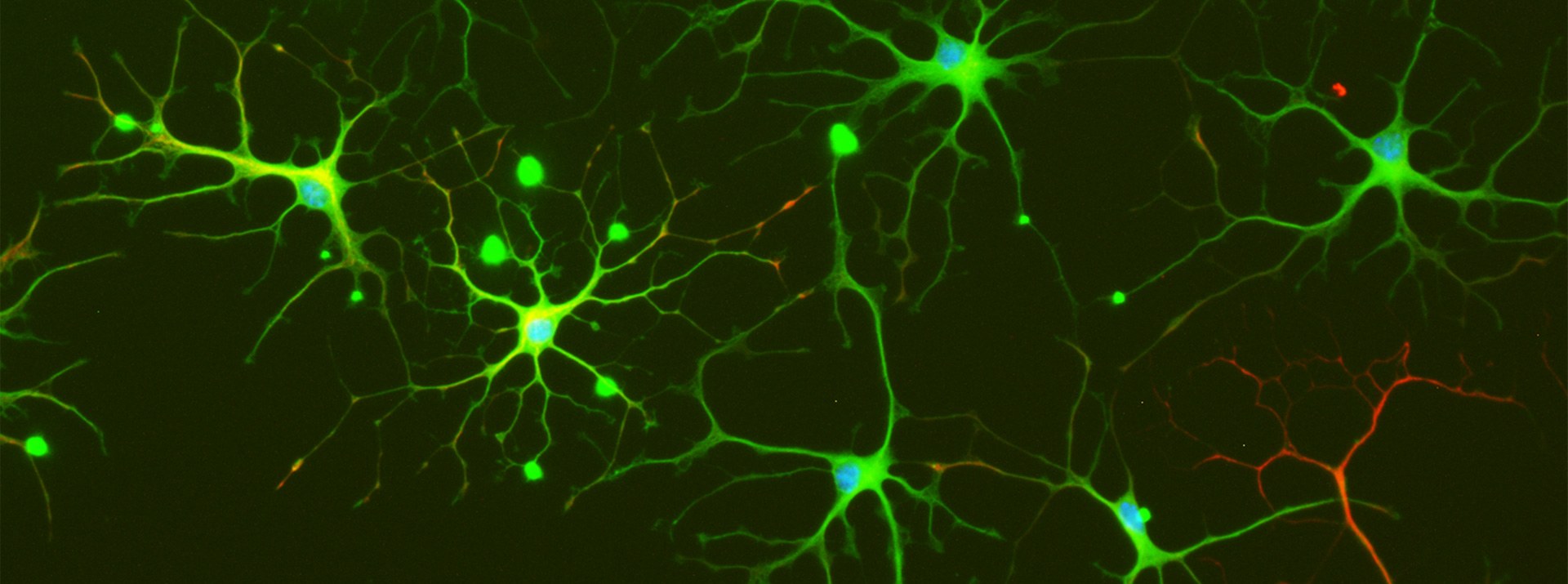 Roles of chromatin-associated factors in neurological disease