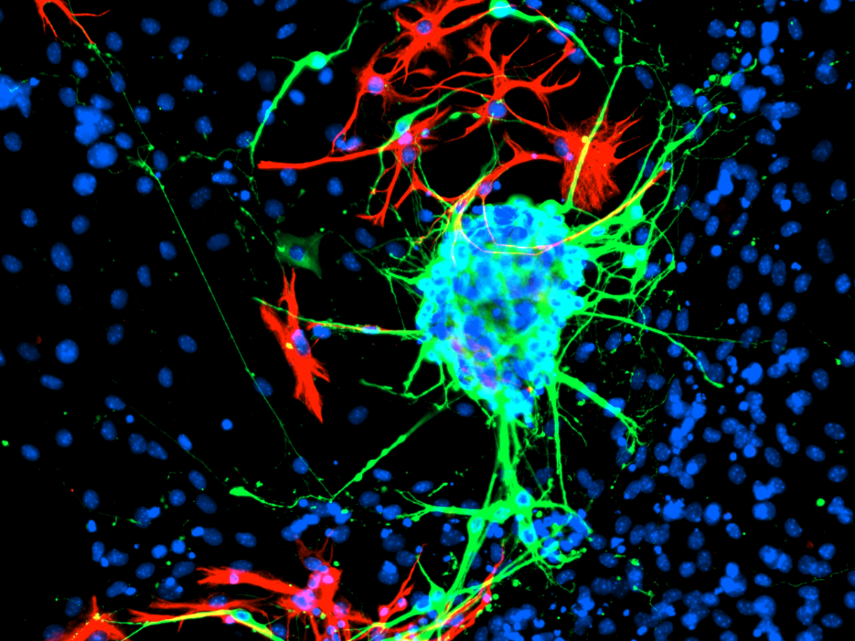 ESC-derived neuronal cells