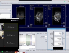 MRI on zoom