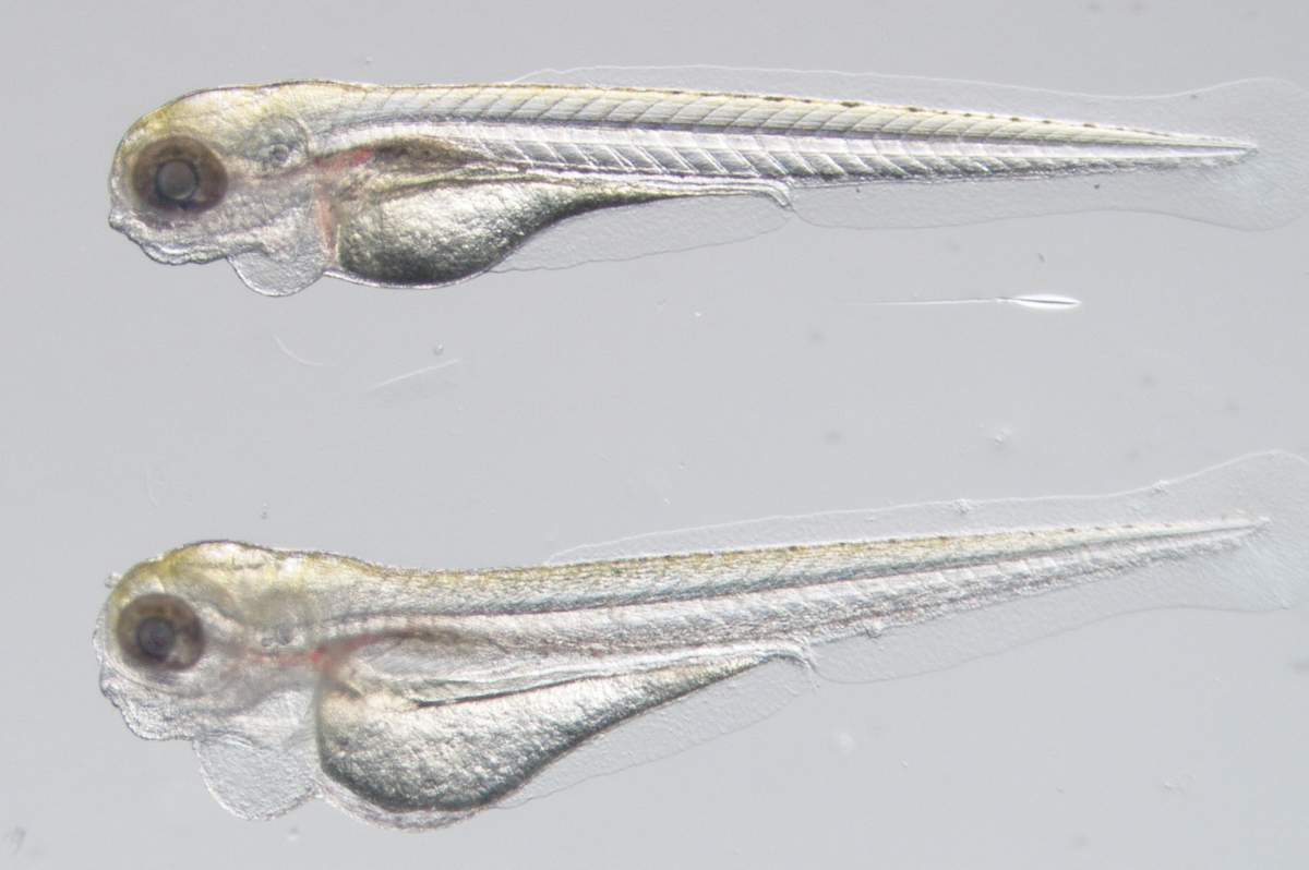 Five-day-old zebrafish embryos viewed under a microscope: the regular embryo (top) and a mutant one (bottom) carrying the mutated NRAS gene from a KLA patient. In the mutant, the main lymphatic vessel is abnormally enlarged
