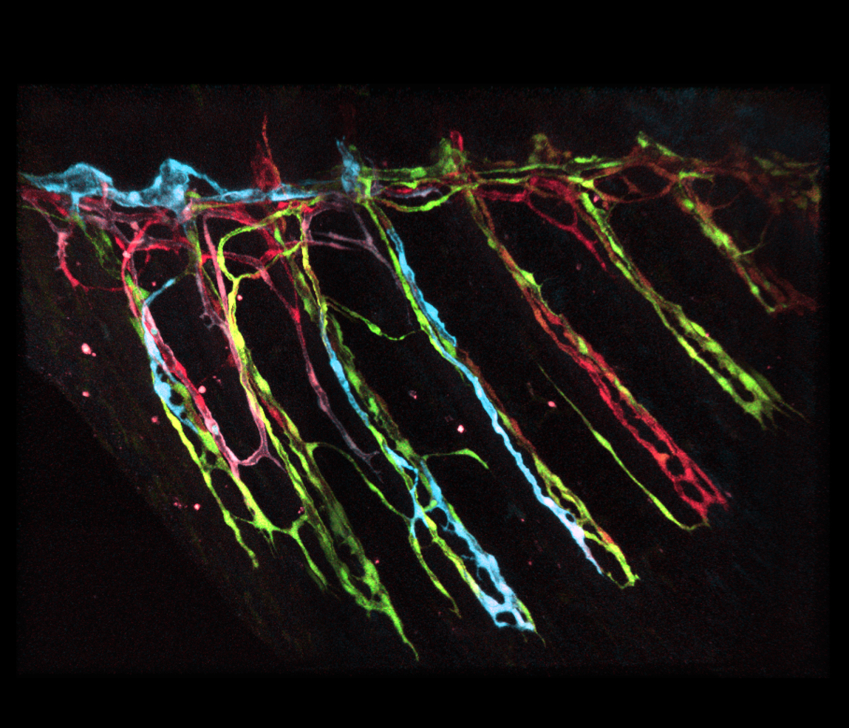 Lymphatic to Blood Vessel Transdifferentiation 