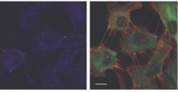 A reciprocal tensin-3-cten switch mediates EGF-driven mammary cell migration