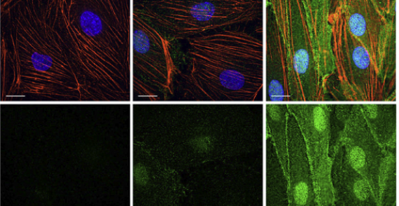 M-sec regulates polarized secretion of inflammatory endothelial chemokines and facilitates CCL2-mediated lymphocyte transendothelial migration