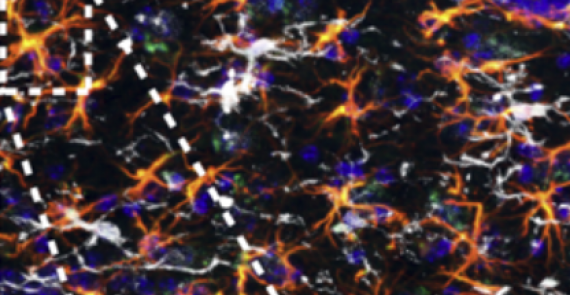 PD-1/PD-L1 checkpoint blockade harnesses monocyte-derived macrophages to combat cognitive impairment in a tauopathy mouse model