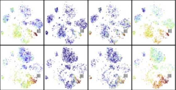 Innate Immune Landscape in Early Lung Adenocarcinoma by Paired Single-Cell Analyses