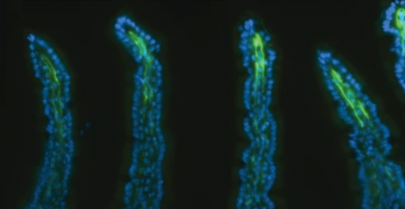 Lgr5+telocytes are a signaling source at the intestinal villus tip
