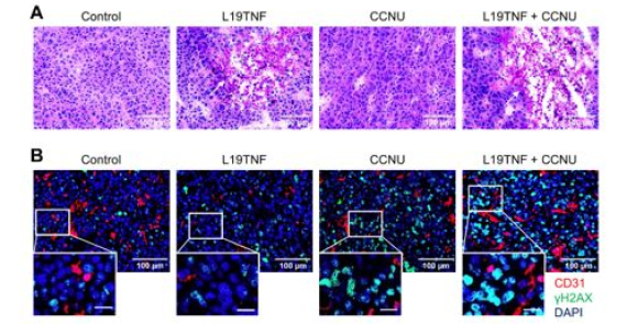 Targeted delivery of tumor necrosis factor in combination with CCNU induces a T cell-dependent regression of glioblastoma