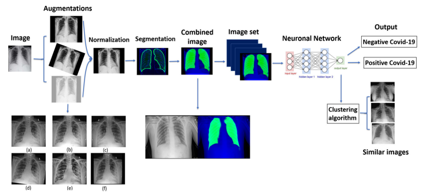 D. Keidar et. al, “COVID-19 Classification of X-ray Images Using Deep Neural Networks”, European Radiology, May 2021