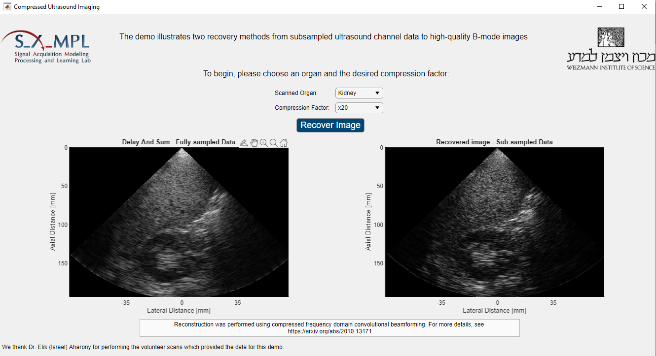 ultrasound2