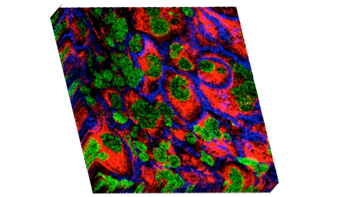 Novel techniques for interrogating tissue pathology picture