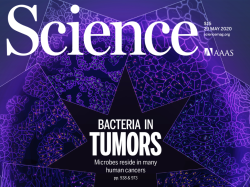 The human tumor microbiome is composed of tumor type–specific intracellular bacteria