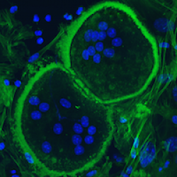 Tyrosine Phosphatases in Bone Biology