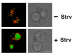 GFP-Yif1 (green) localizes to the Golgi under normal growth conditions, but relocalizes and is degraded in the vacuole (red) upon starvation (STRV) and TOR activation