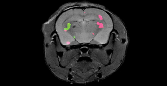Two different proteins expressed in a mouse brain are revealed by dual-color MRI