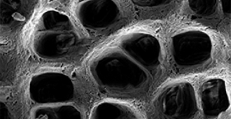 The extracellular matrix as captured by a scanning electron microscope (SEM)