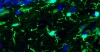 microglia
