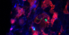 Fluorescence microscopy image of Salmonella (green) engulfed by splenic macrophages (red; blue – cell nuclei)